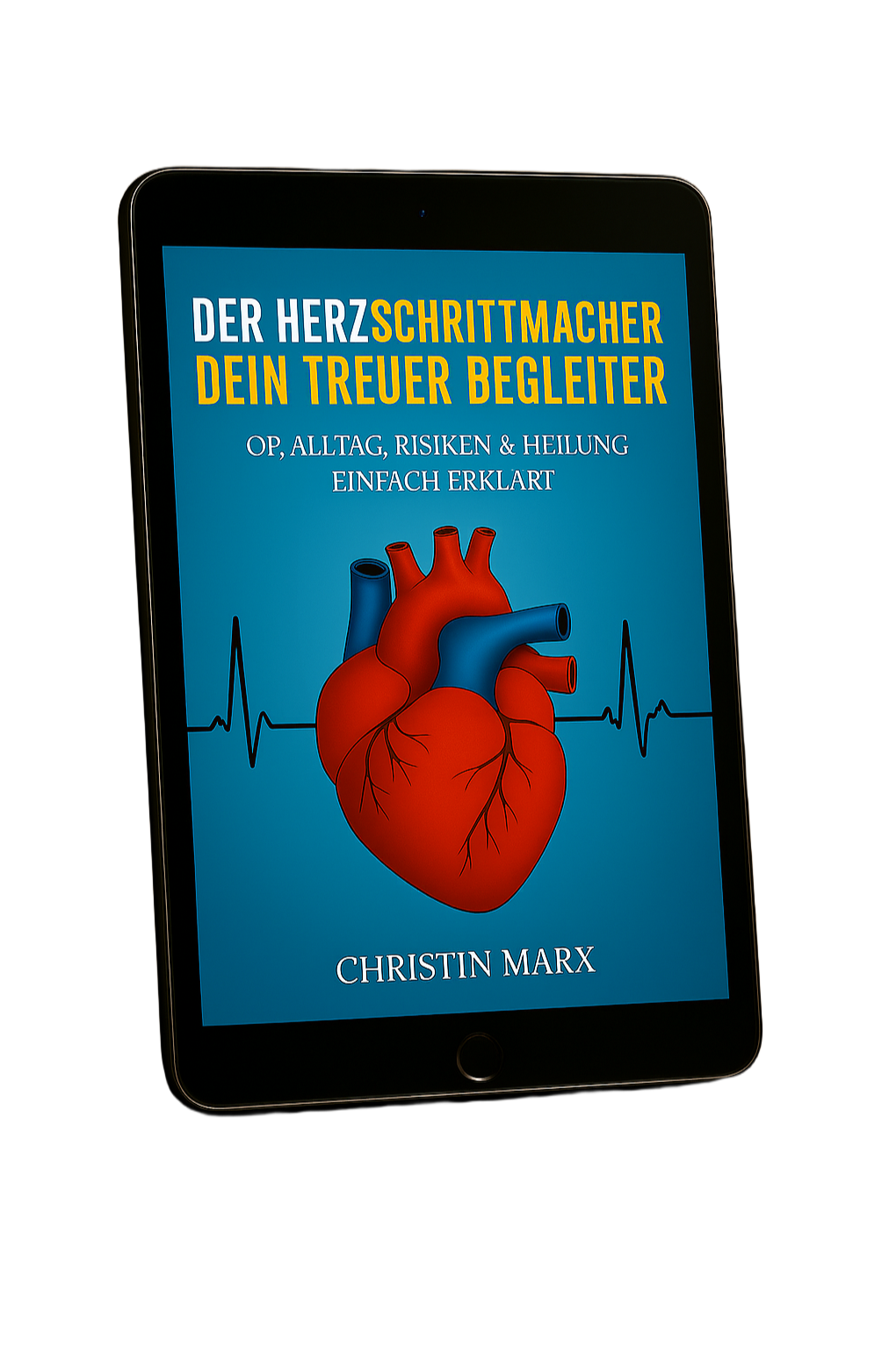 E-Book-Cover: Der Herzschrittmacher – Dein treuer Begleiter von Christin Marx, OP, Alltag, Risiken & Heilung einfach erklärt
